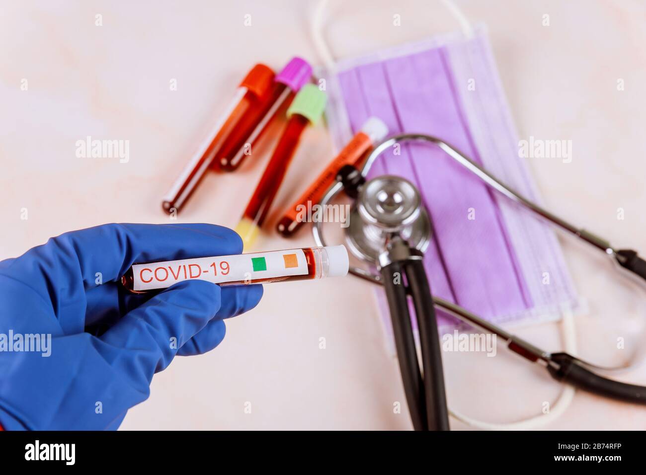 COVID19 virus definition Middle East Respiratory Syndrome Blood sample