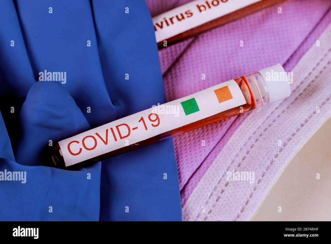 Coronavirus chinese infection blood sample test with COVID19 blood