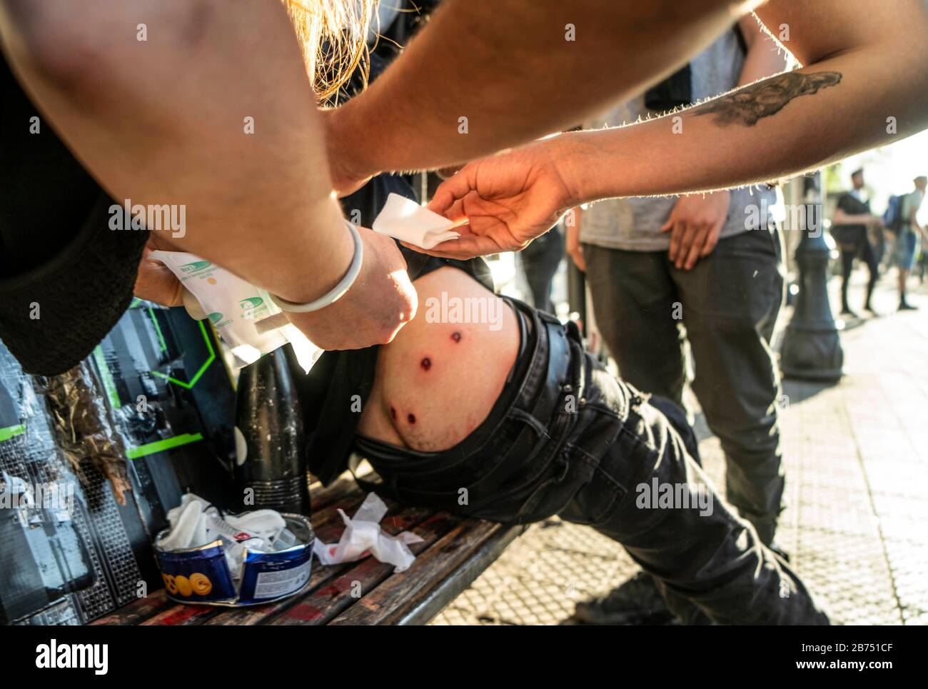 Chile, Santiago, 24.10.2019. Santiago in state of emergency on 24.10.2019. Demonstration at Plaza Baquedano in Santiago. Demonstrators injured by rubber bullets. [automated translation] Stock Photo