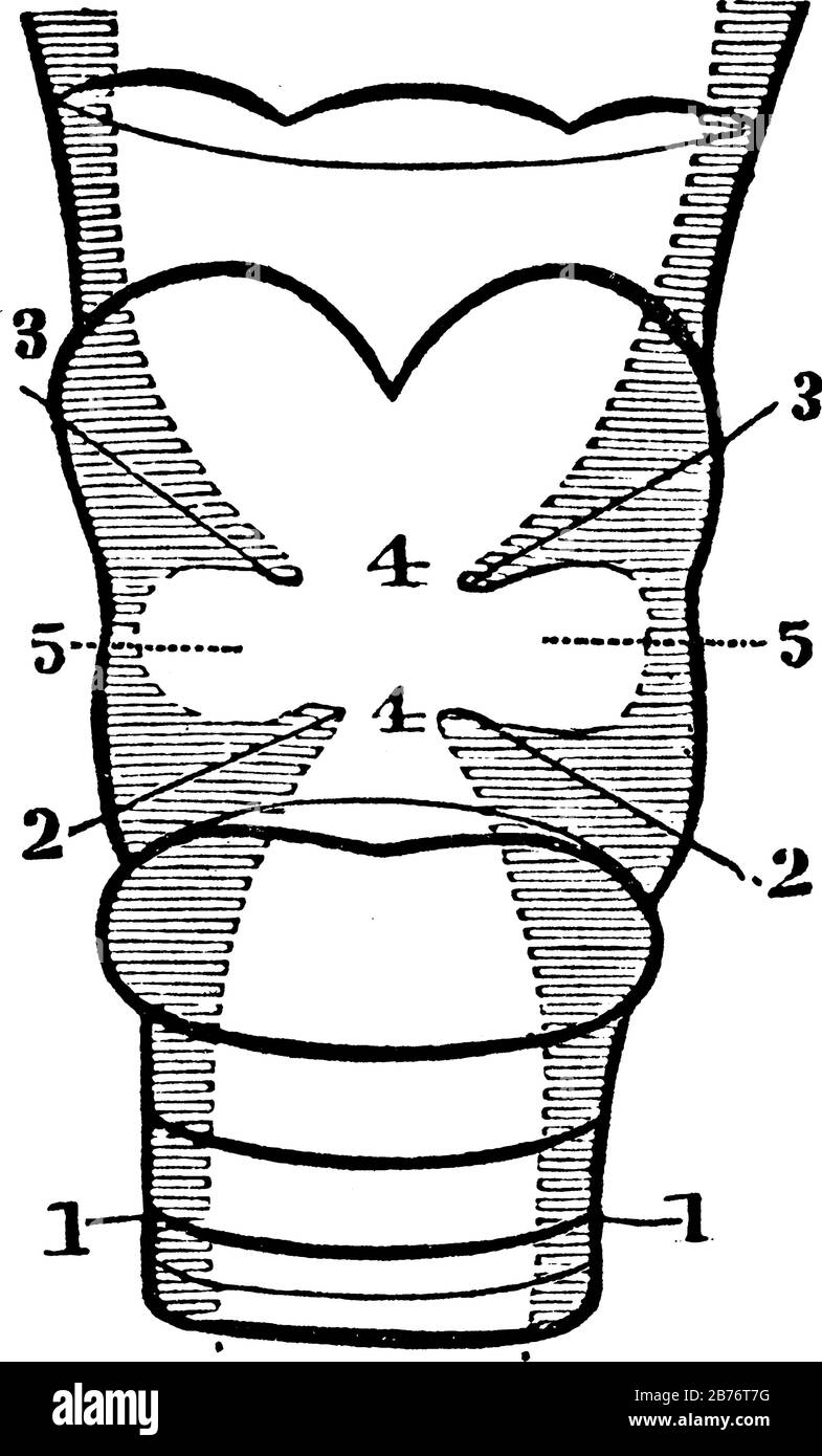 A section of the larynx. Labels: 1, The trachea. 2, The lower vocal cords. 3, The upper vocal cords. 4, Glottis. 5, The ventricles of the larynx, vint Stock Vector