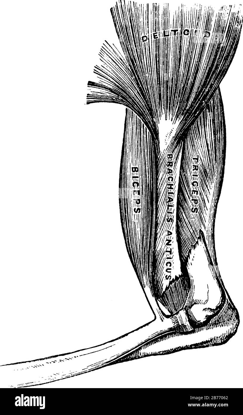 Muscles of the arm include deltoid muscle, biceps muscle, and triceps muscle. A bone is fractured near elbow, vintage line drawing or engraving illust Stock Vector