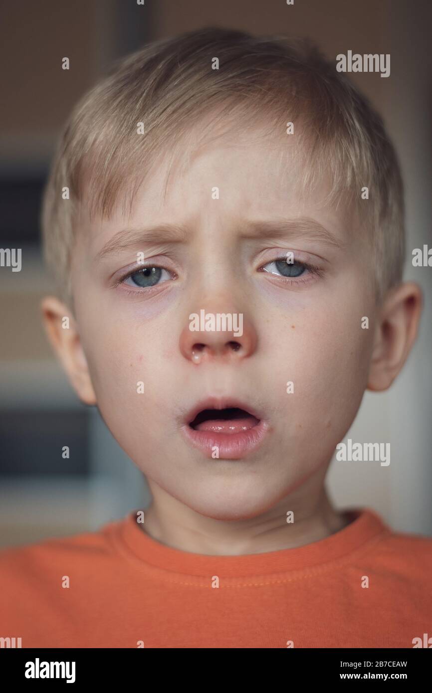 Five years old boy with allergy runny nose and glazed eyes. Stock Photo