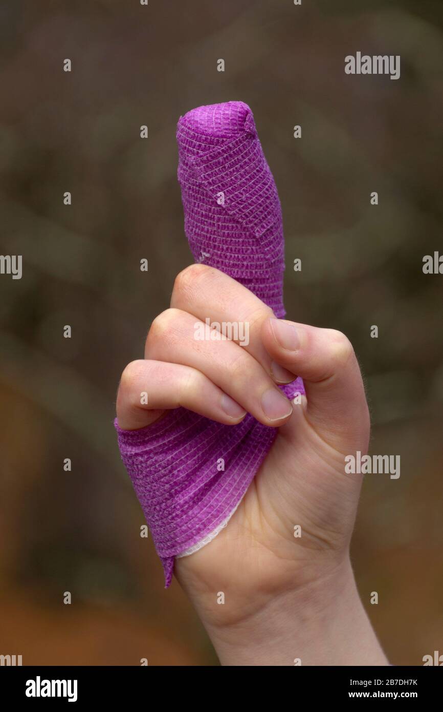 Closeup of a young woman's sutured finger wrapped in winding layers of colorful purple gauze Stock Photo