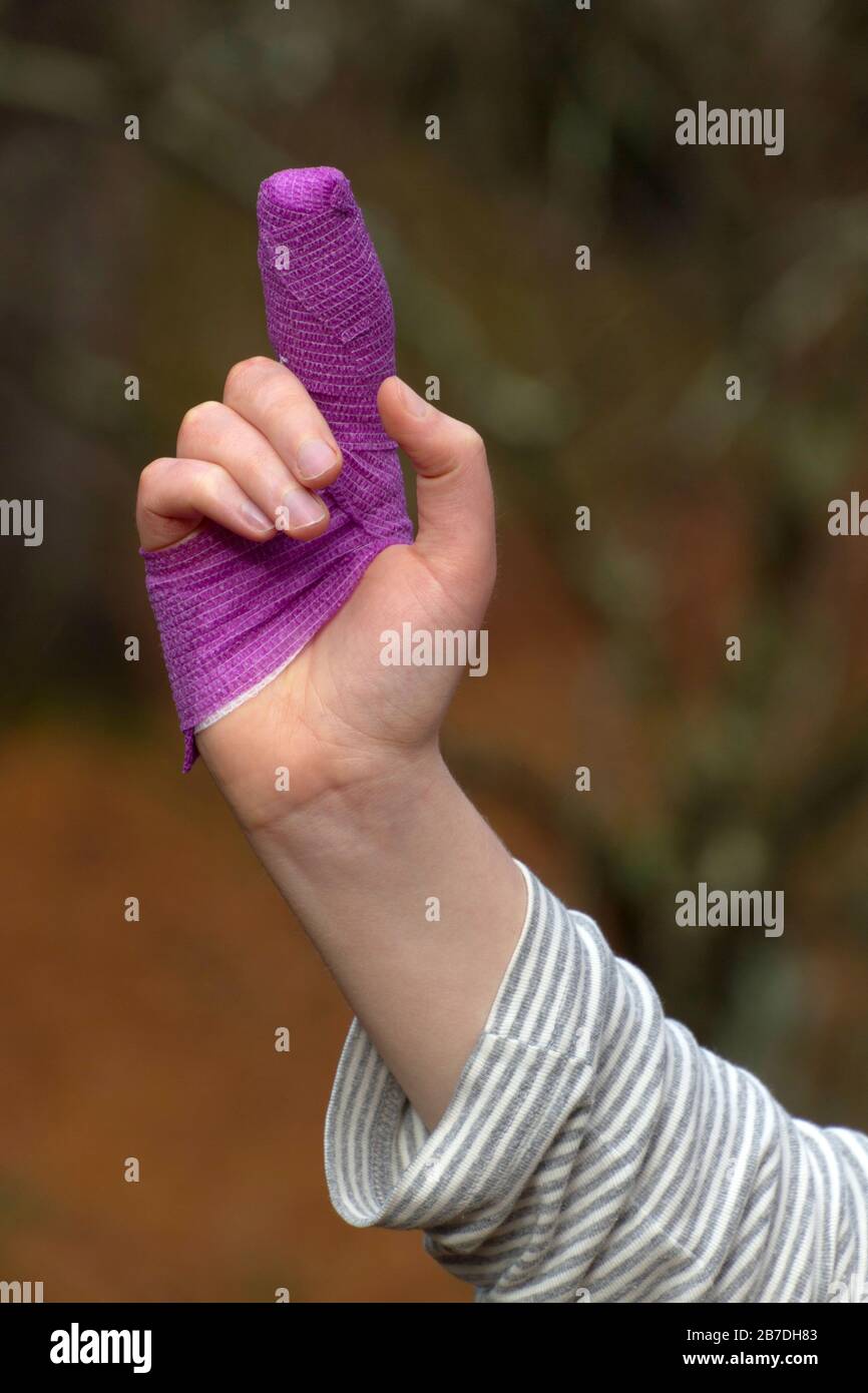 Closeup of a young woman's sutured finger wrapped in winding layers of colorful purple gauze Stock Photo