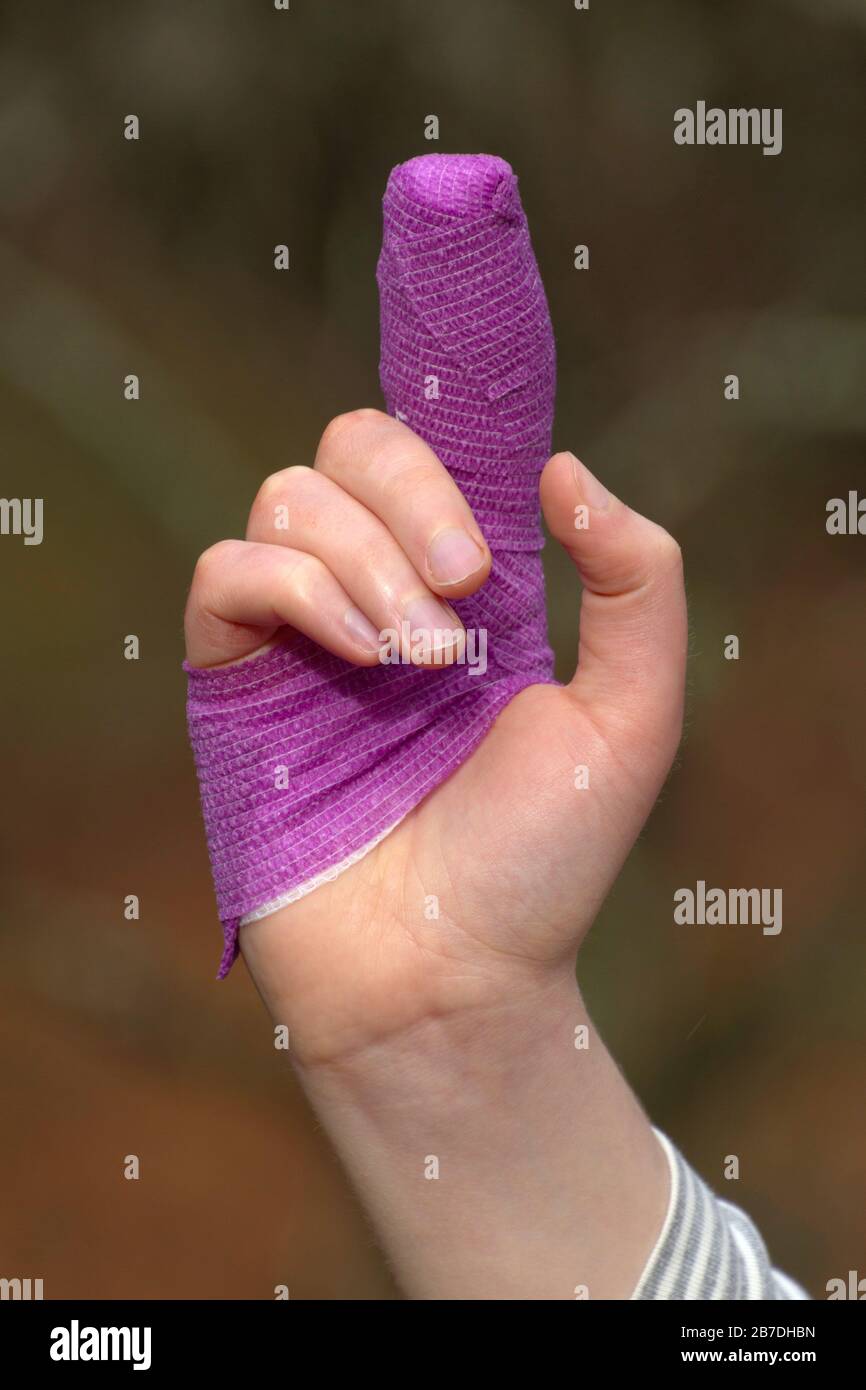 Close up of a young woman's sutured finger wrapped in winding layers of colorful purple gauze Stock Photo