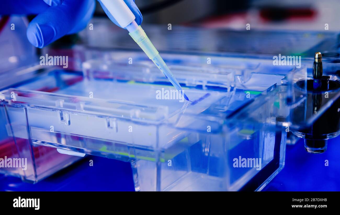 Protein separation on gels in a Electrophoresis chambers. Concept of