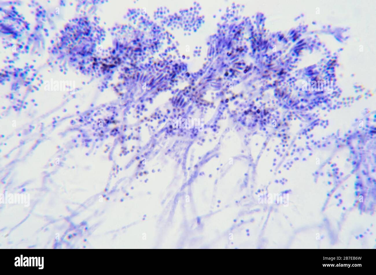 Penicillium branches, ascomycetous fungi under the microscope. To humans ascomycetes are a source of medicinal compounds, like antibiotics. Stock Photo
