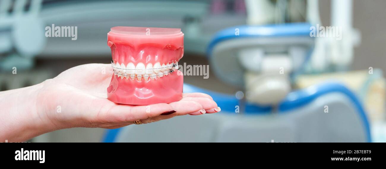 Orthodontic model and dentist tool - demonstration teeth model of ...