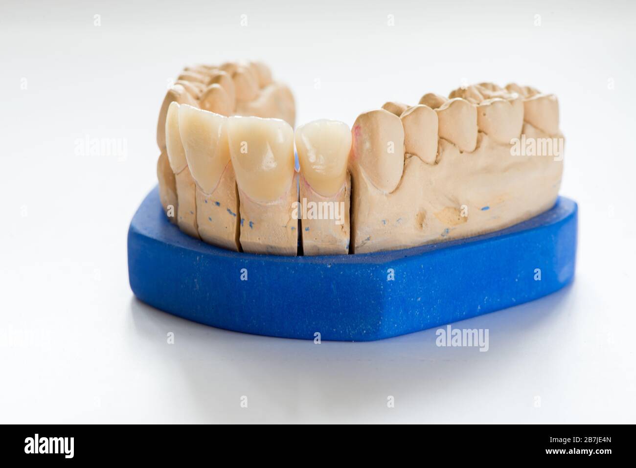 Dental gypsum model in dentist laboratory office closeup. Gypsum