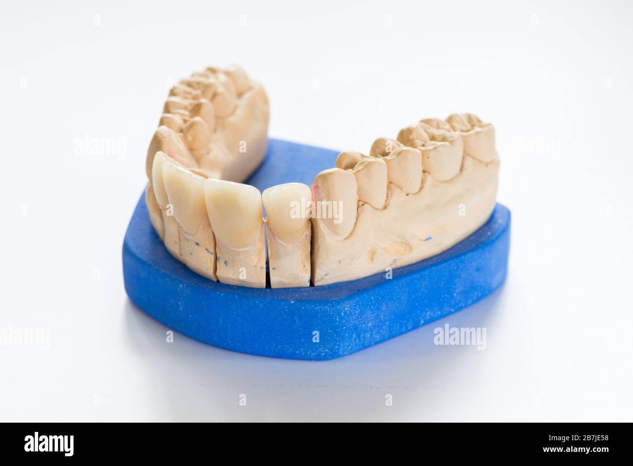 Dental gypsum model in dentist laboratory office closeup. Gypsum