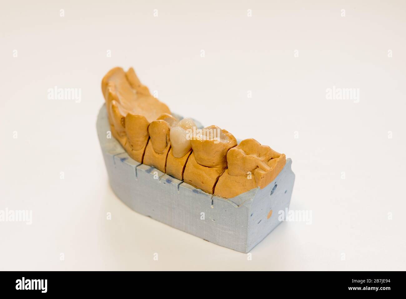 Dental gypsum model in dentist laboratory office - close-up.  Gypsum Dentures with porcelain teeth isolated on white background - copy space Stock Photo