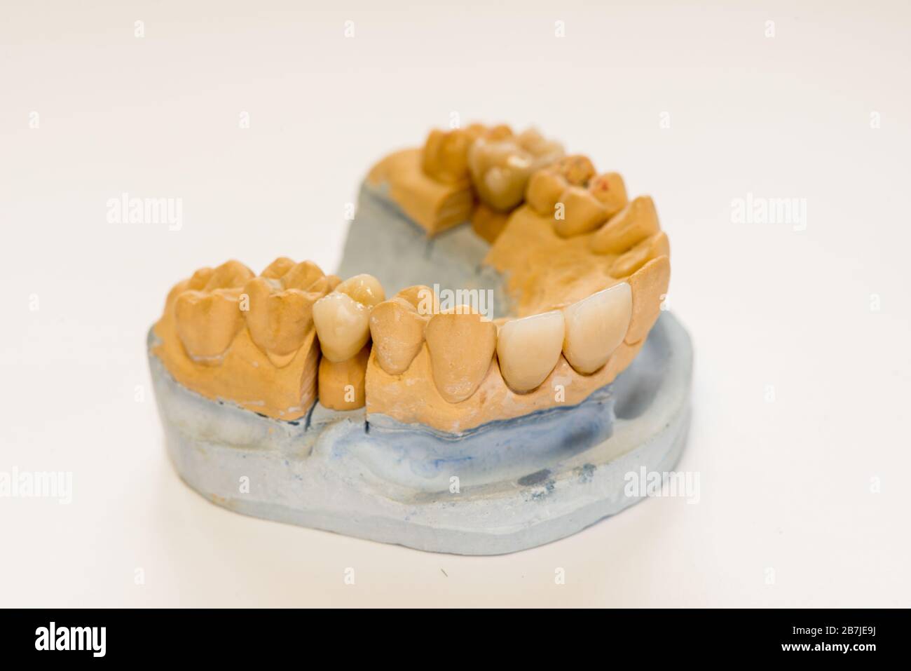 Dental gypsum model in dentist laboratory office closeup. Gypsum