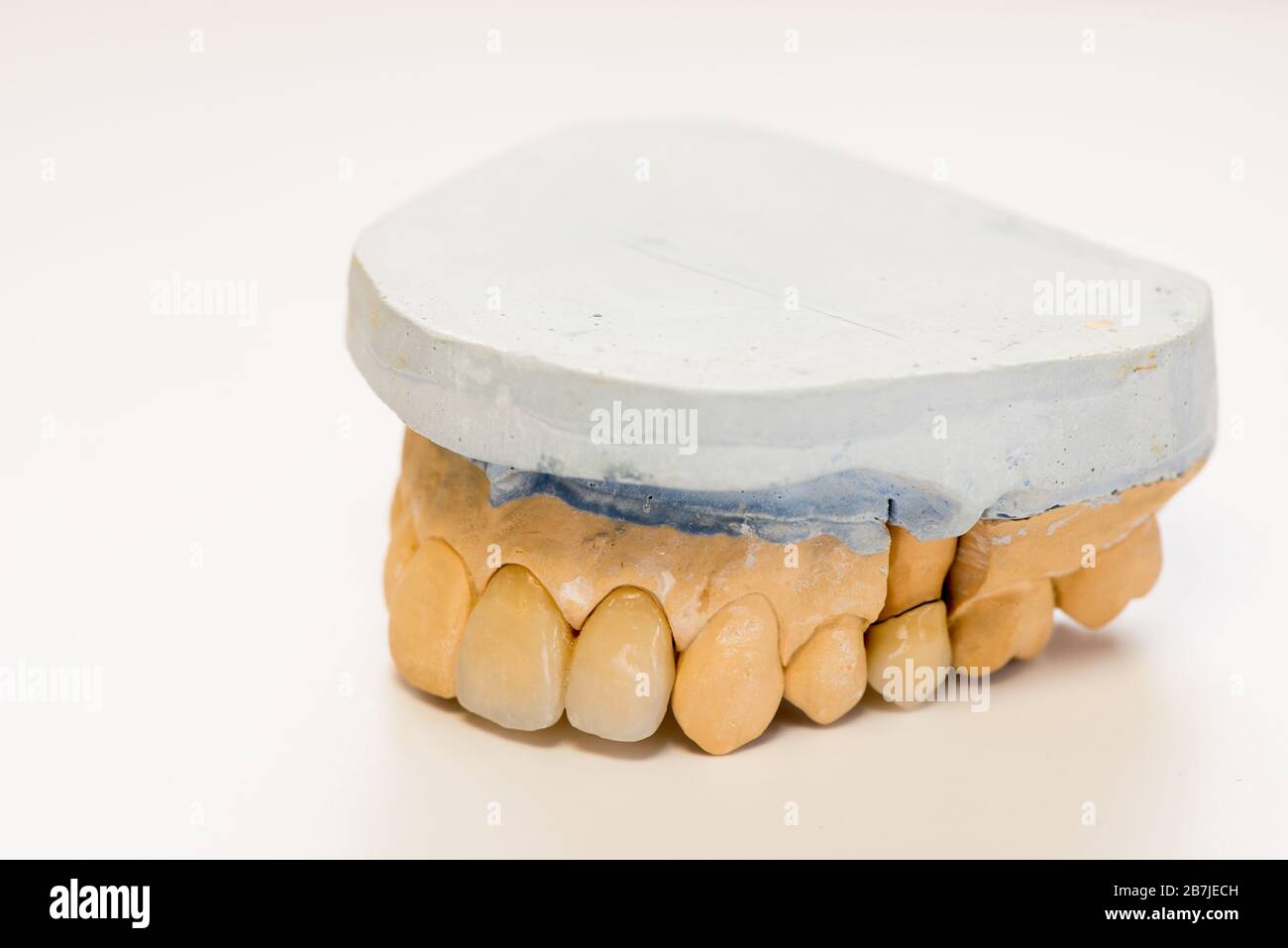Dental gypsum model in dentist laboratory office closeup. Gypsum