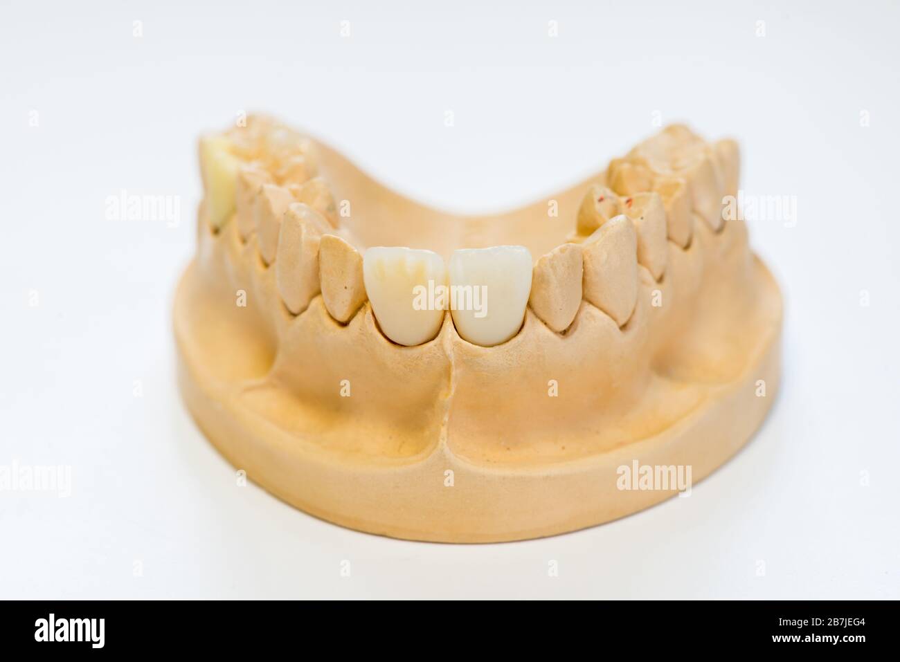 Dental gypsum model in dentist laboratory office closeup. Gypsum