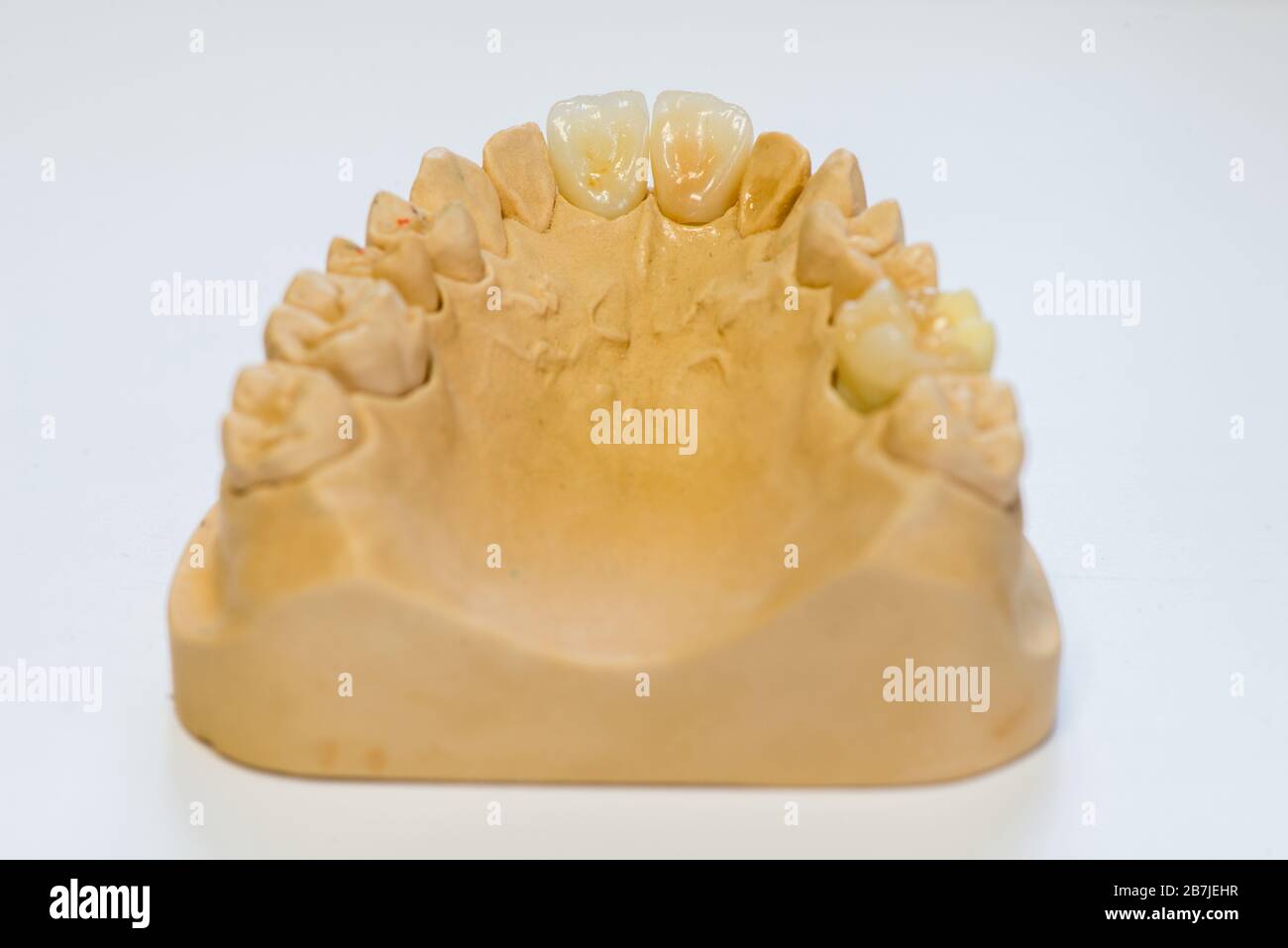 Dental gypsum model in dentist laboratory office closeup. Gypsum