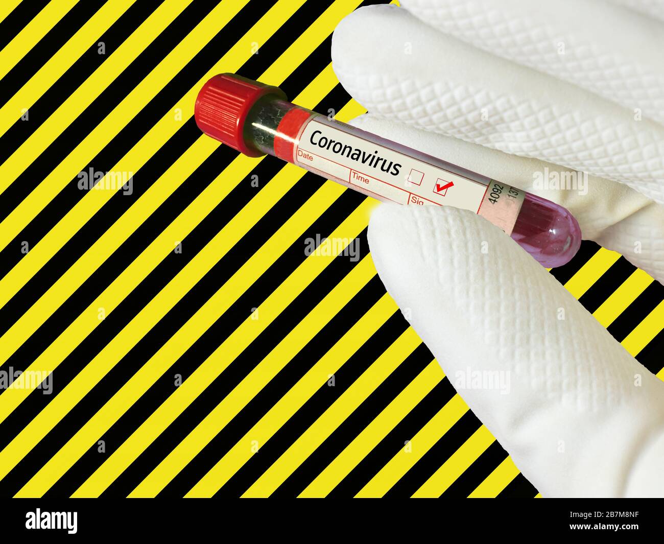 Warning Sign Coronavirus Alarm Symbol Blood Tube Stock Photo