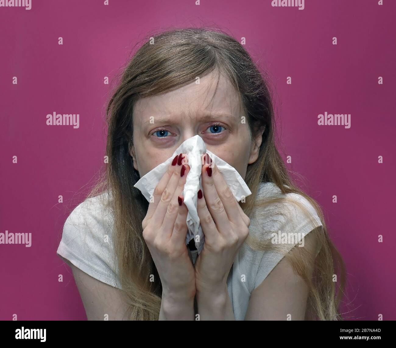 Sick young woman blowing her nose into paper tissue Stock Photo