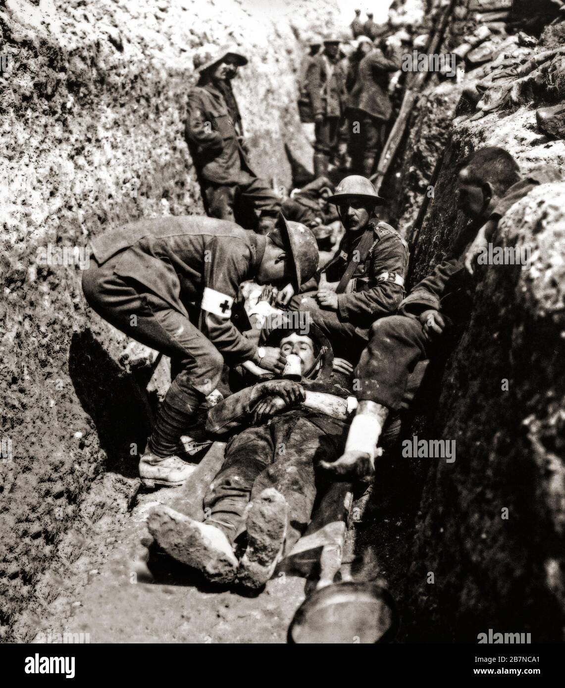 British stretcher bearers giving aid to a wounded soldier during the Battle of the Somme also known as the Somme Offensive, that took place between 1 July and 18 November 1916 on both sides of the upper reaches of the River Somme in France. Stock Photo