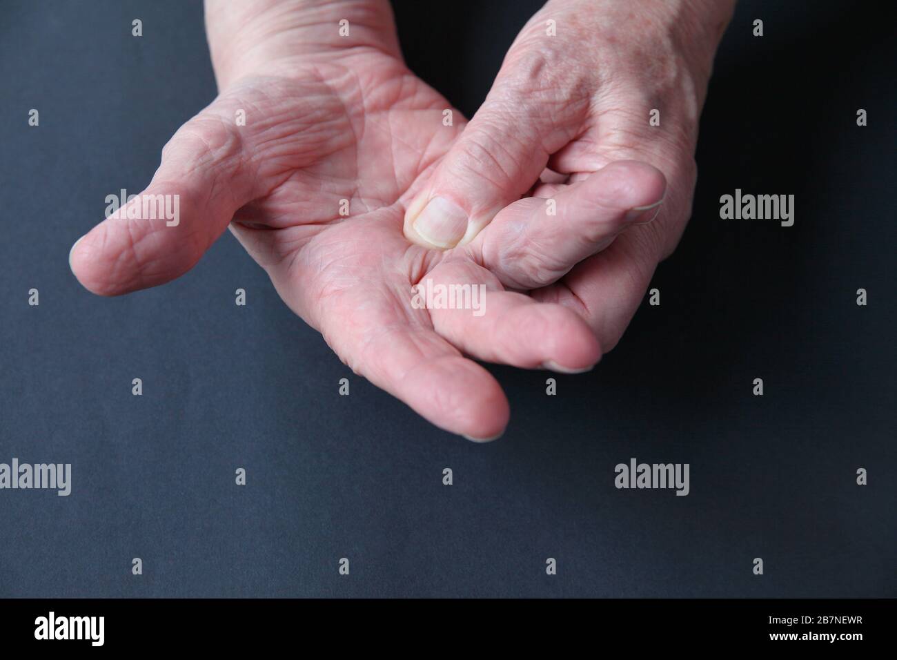 Senior man puts pressure on a sore area of his hand Stock Photo