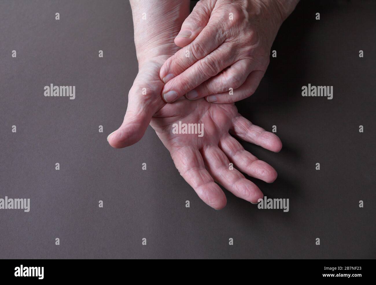 An older man indicates an area of pain on his thumb Stock Photo