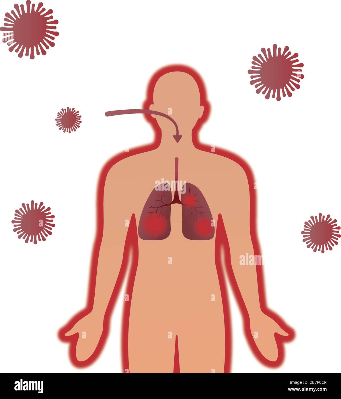 Wuhan coronavirus covit 19 related , human character, lungs infection or defected virus lungs and bacteria dangerous for health vectors illustration Stock Vector