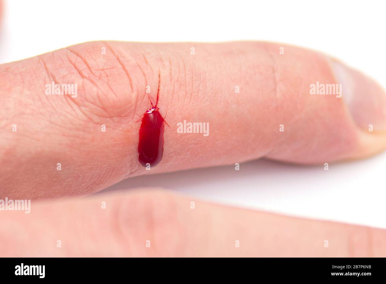 Close-up Finger with natural wound and drop of Blood, Injured Finger Stock Photo