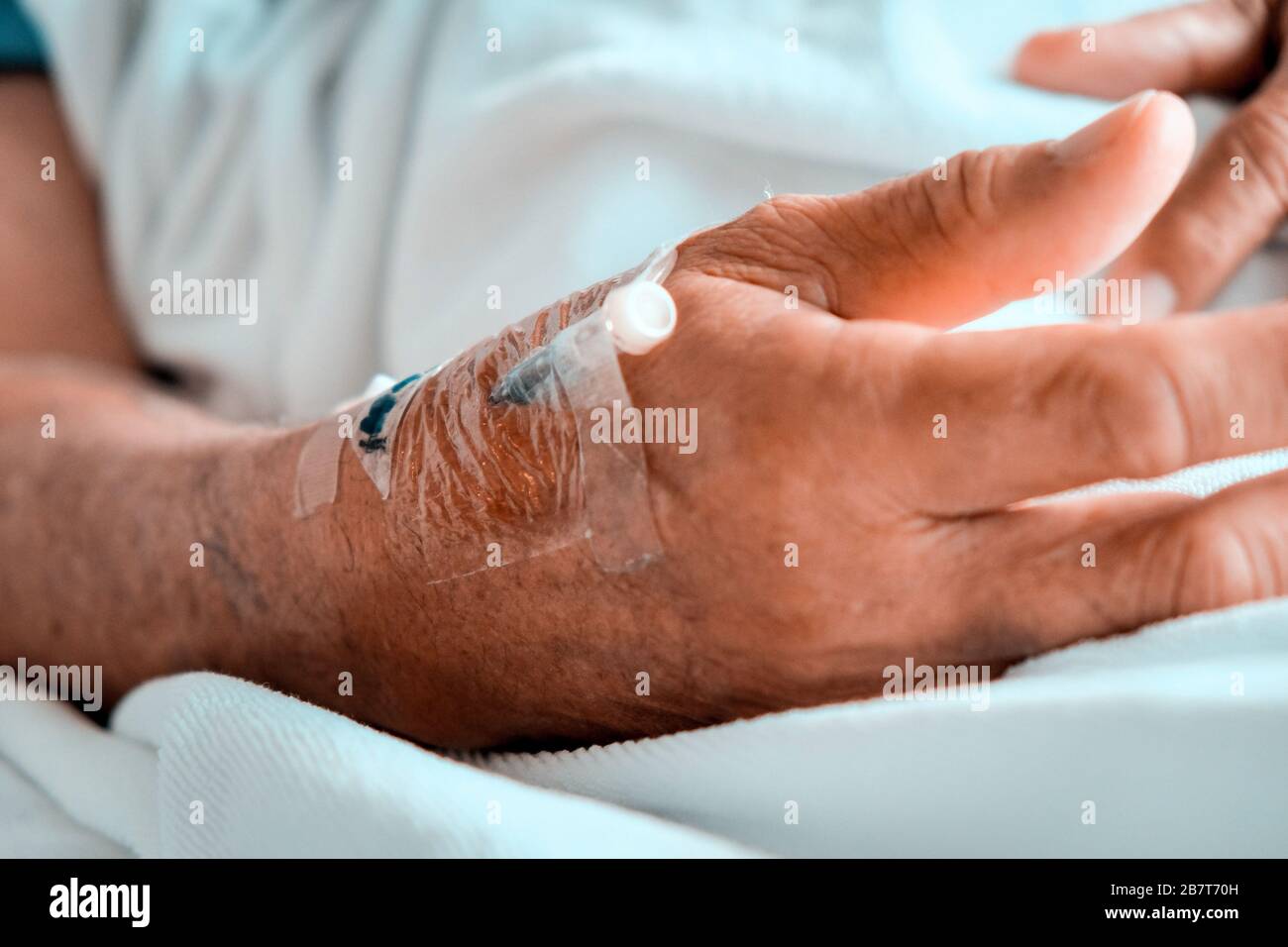 Iv In My Hand Medical Care, Close up image of IV drip in patient's hand in hospital ...