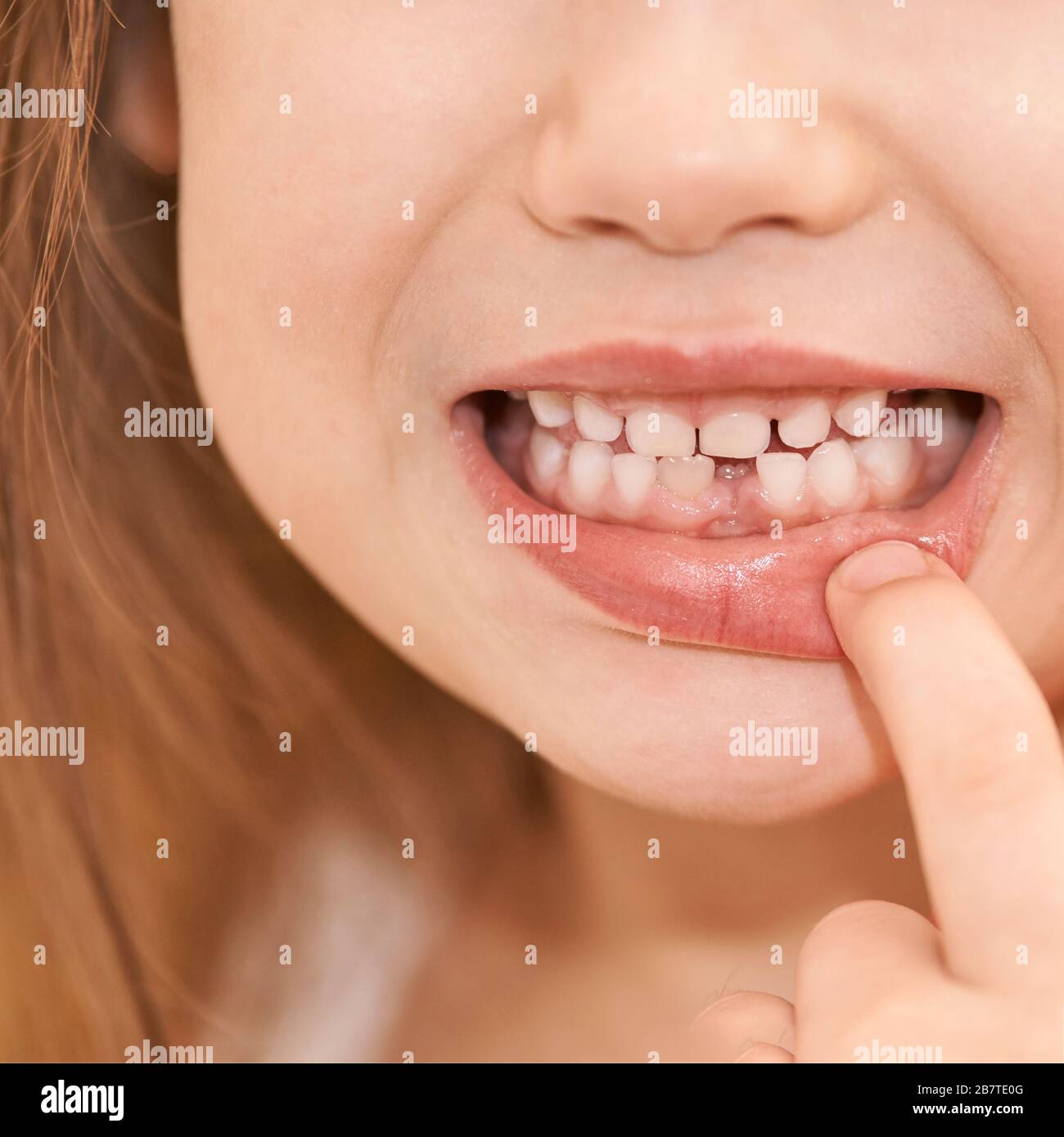 Young girl point on milk tooth. Baby losing teeth Stock Photo Alamy