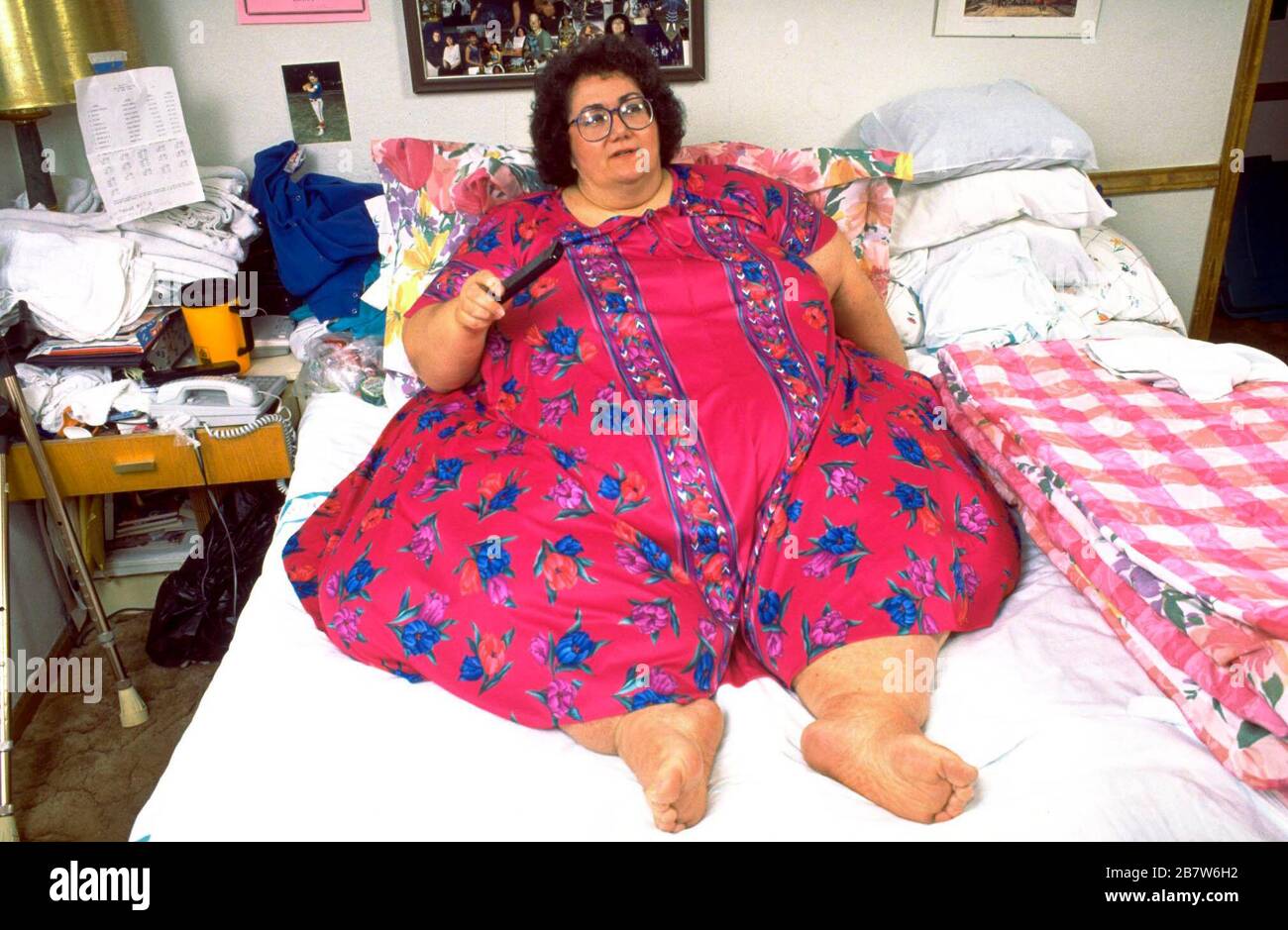 Killeen Texas USA, 1993 Morbidly obese woman weighing 600+ lbs. confined to bed due to her