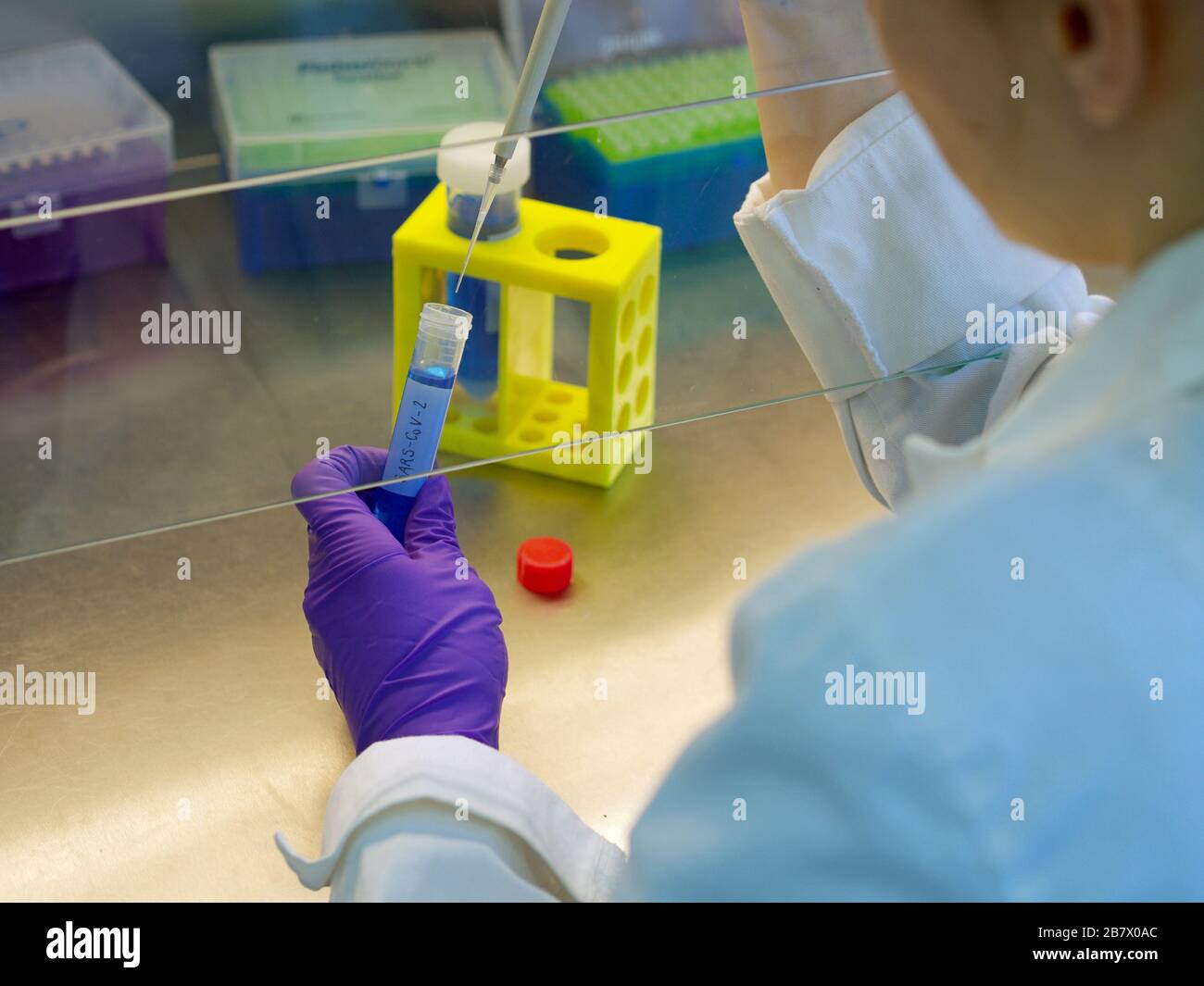 Lab Instrument Rep Covid Testing Lab worker, laboratory testing, coronavirus lab, Sars-CoV-19, test ...