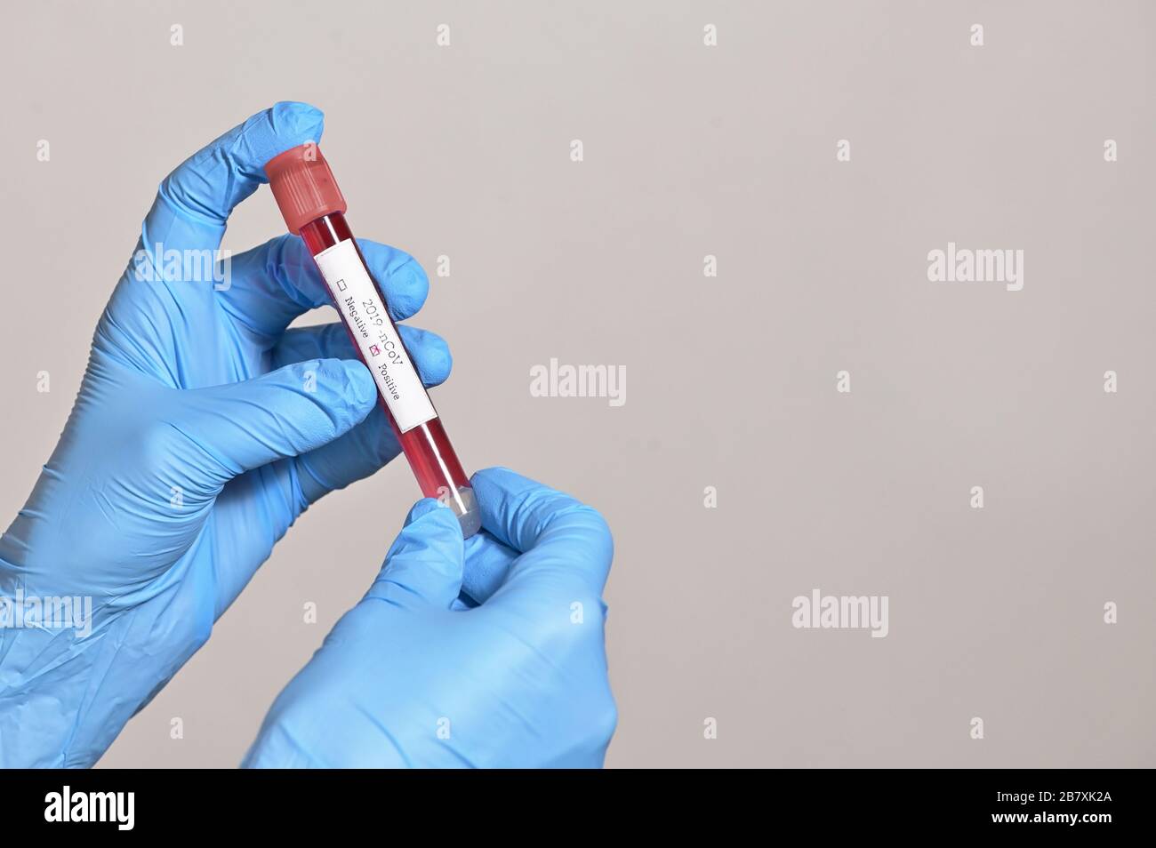 Coronavirus 2019-Ncov With Positive Blood Test Stock Photo