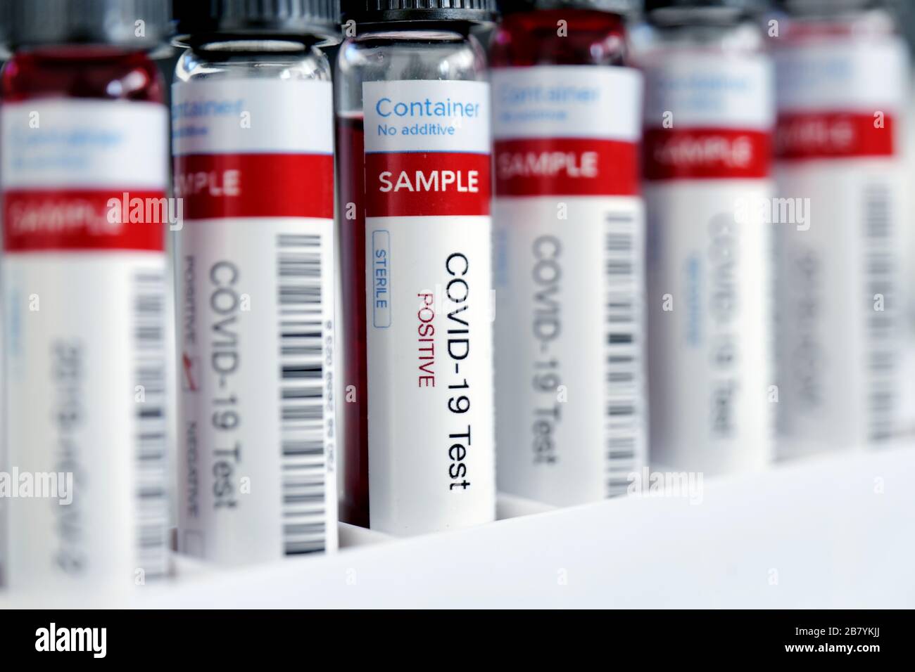 Testing for presence of coronavirus. Many tubes containing blood samples that have tested positive for COVID-19. Stock Photo