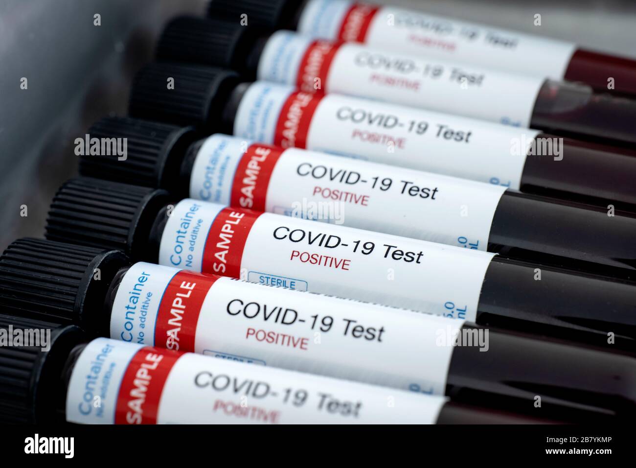 Testing for presence of coronavirus. Many tubes containing blood samples that have tested positive for COVID-19. Stock Photo