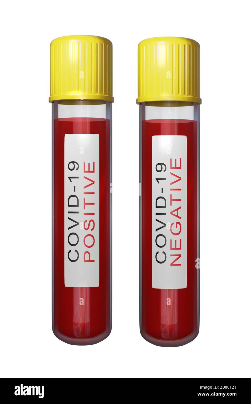 3d rendering of two tubes with a blood test for covid-19 in a ...