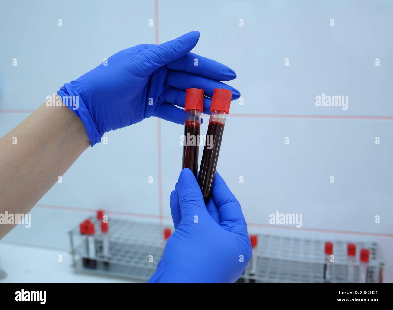 Lab assistant hands holding vacutainers with blood inside Stock Photo