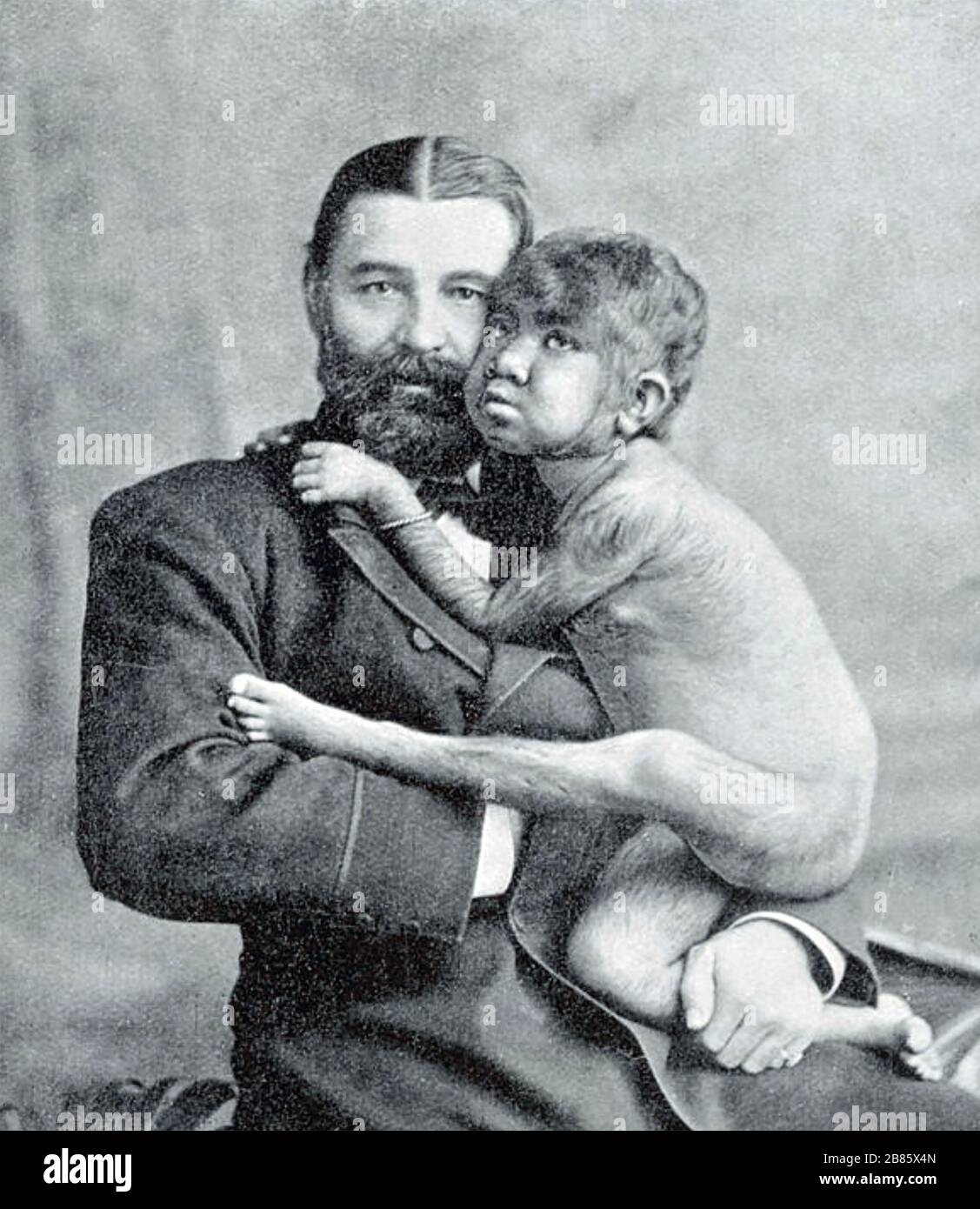 KRAO FARINI (1876-1926) American sideshow performer with her adopted parent Guillermo Farini Stock Photo