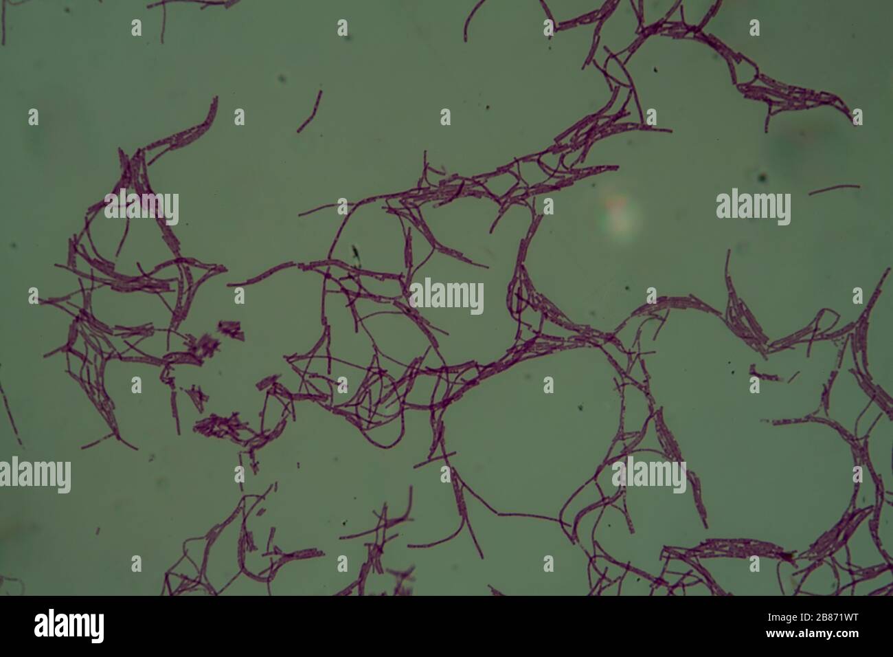 Bacillus anthracis anthrax under the microscope 200x Stock Photo Alamy