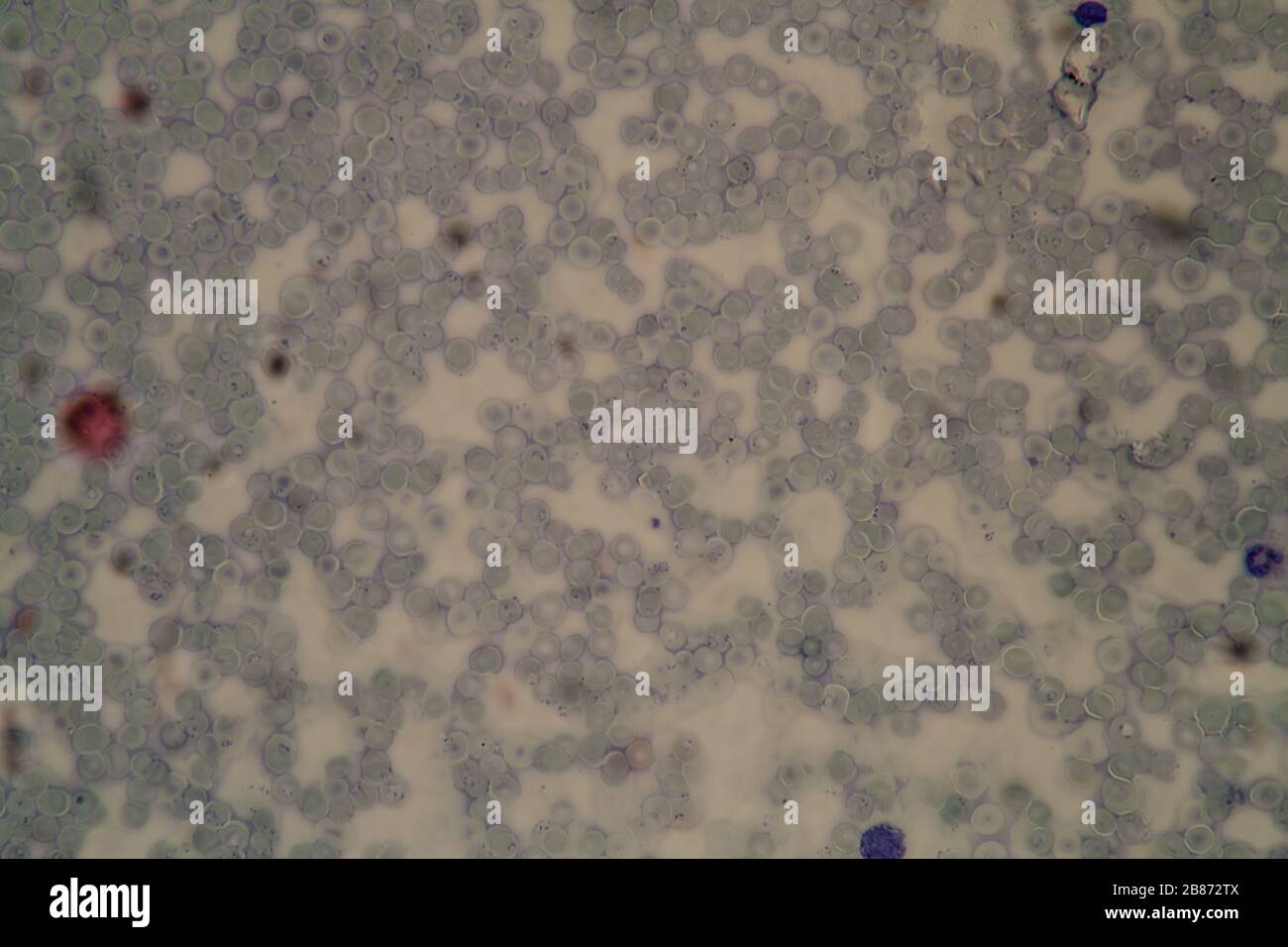 Malaria Parasites In Red Blood Cells Under The Microscope 400x Stock Photo Alamy