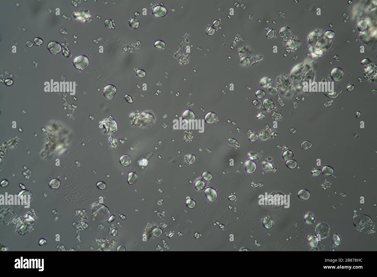 Cereal starch grains under the microscope 200x Stock Photo Alamy