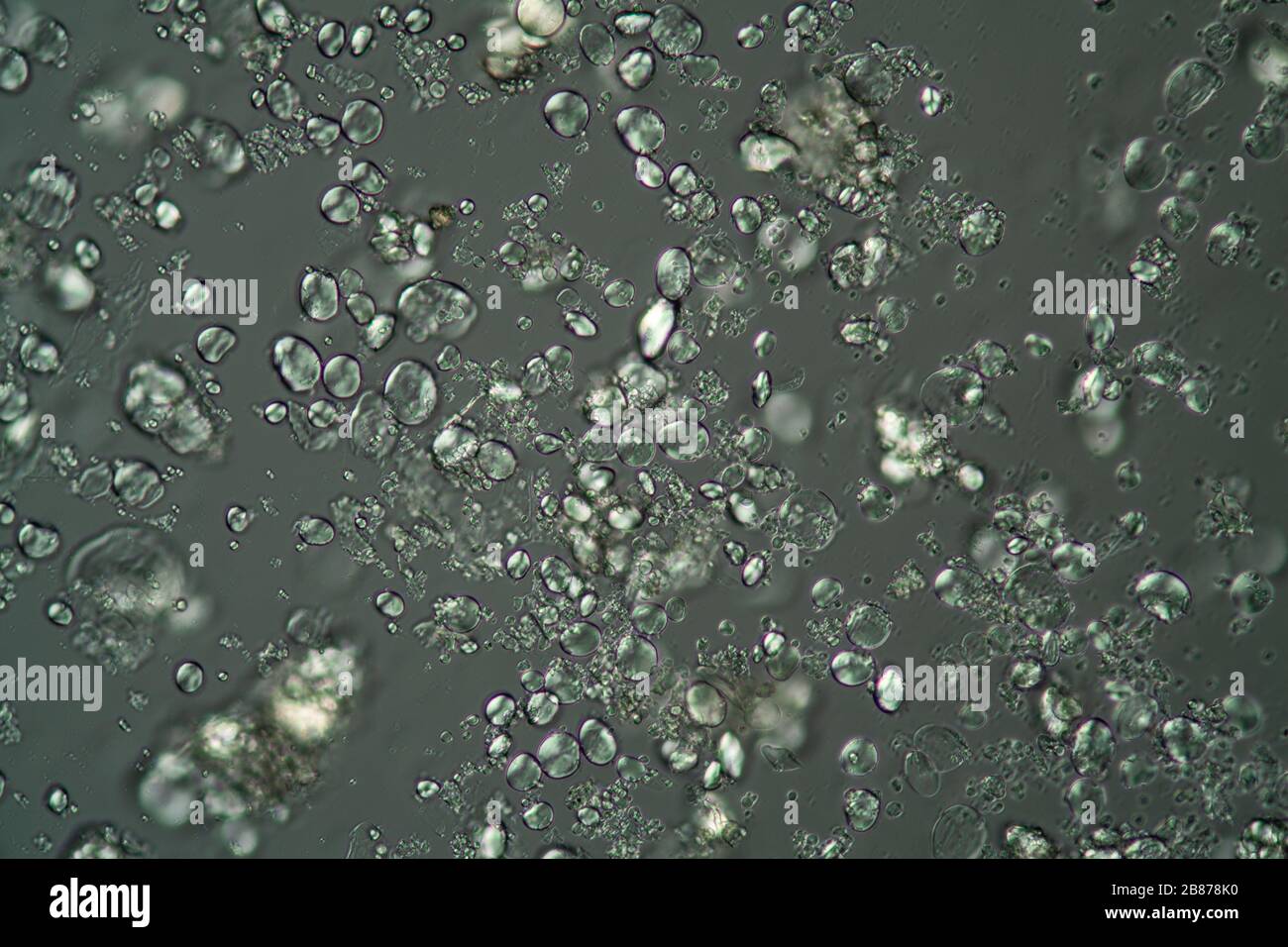Cereal starch grains under the microscope 200x Stock Photo Alamy