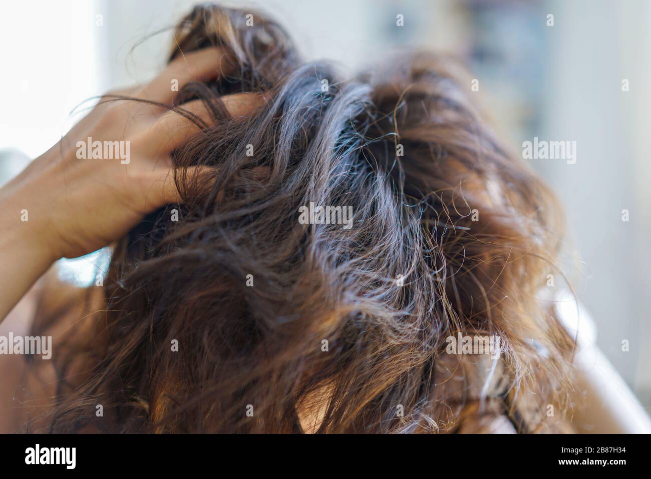 Head of unkempt woman. Itchy scalp or hair loss due to stress. Stock Photo