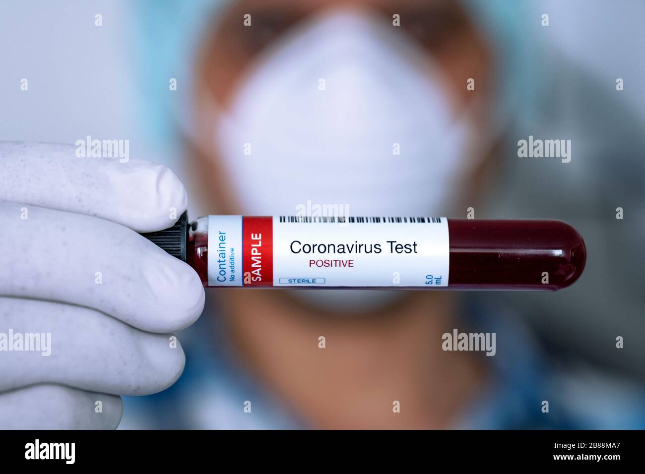 Testing for presence of coronavirus. Doctor holding a tube containing a blood sample for COVID-19 that has tested positive. Stock Photo