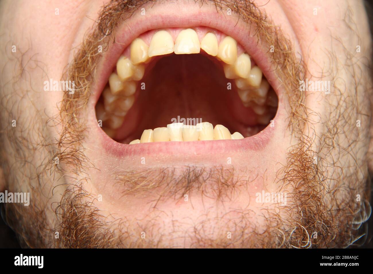 Man open with teeth hi-res stock photography and images - Alamy