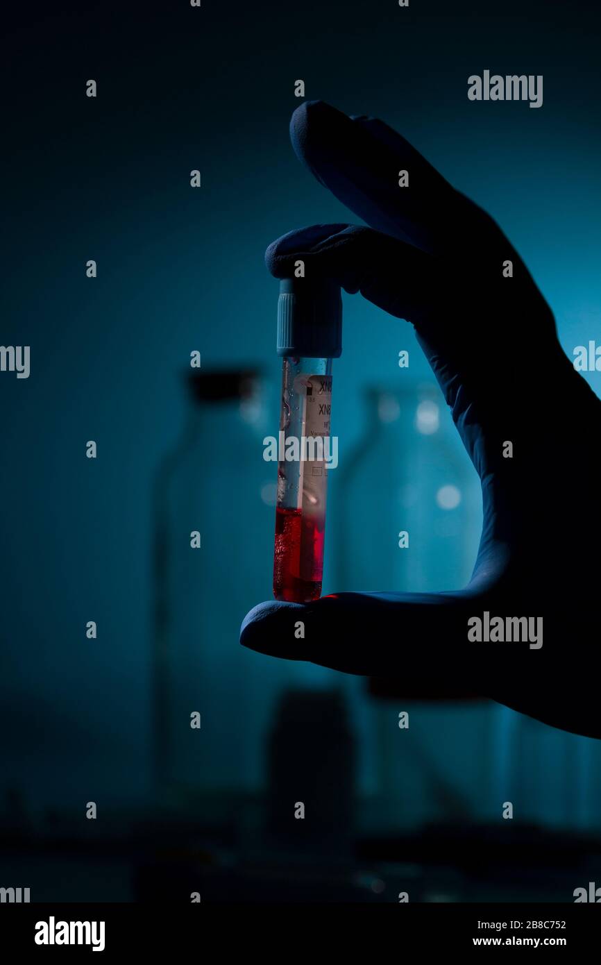 Hand of researcher holds test tube with blood for Coronavirus 2019-nCOV test. Dramatic light Stock Photo