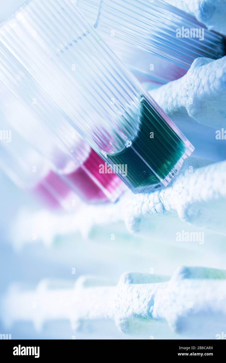 Labware Reactivity Test Reactive tests in the laboratory. Virus Stock Photo - Alamy