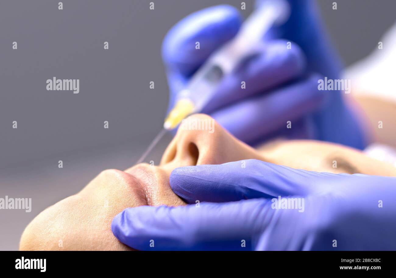 Close up of lip augmentation with injection needle in beauty salon or plastic surgery clinic by doctor. Injecting lips with filler syringe for woman. Stock Photo