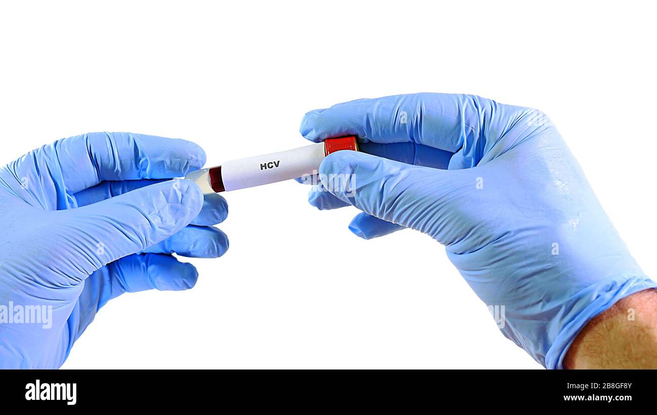 Hand in glove, holds a medical tube with venous blood. It HCV shortcut. Shifts the tube from one hand to the other hand. Isolated on a white backgroun Stock Photo