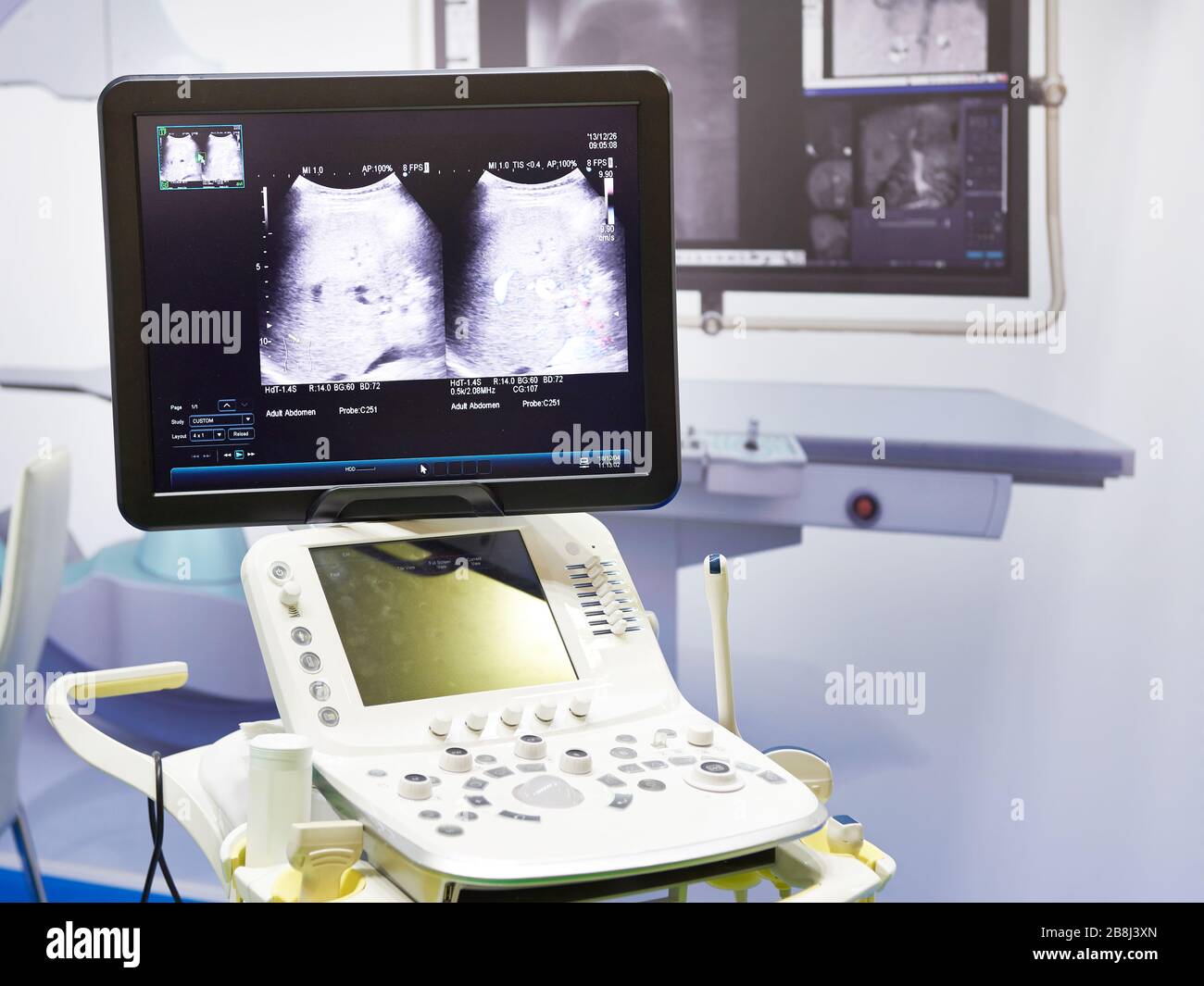 Portable ultrasound scanner hi-res stock photography and images - Alamy