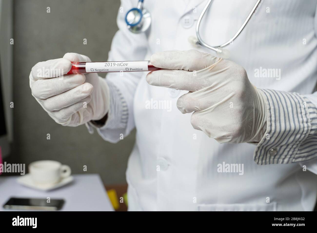 Close up of asian male doctor hands. He takes blood of patient coronavirus in test tube at Hospital. Stock Photo