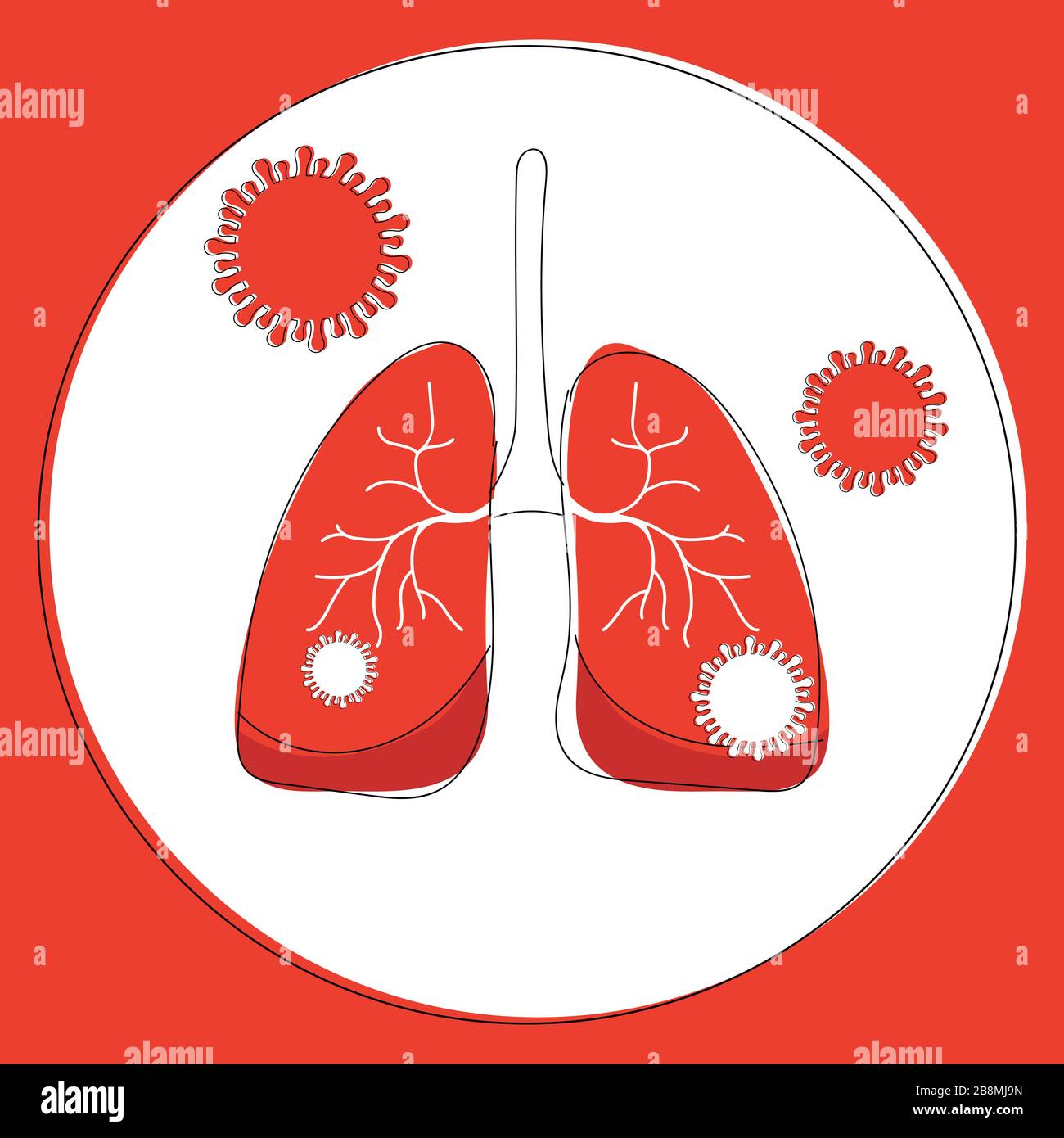 Infected lungs with bacterium illustration, coronavirus outbreak. Bacterial infection in body organs, pneumonia in the lungs, a respiratory disease Stock Vector